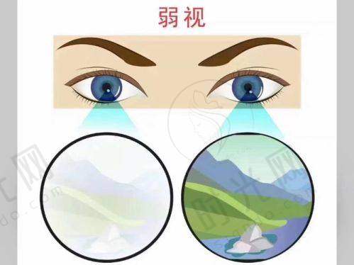 先天性弱视可以做手术吗？