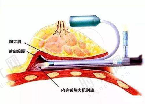 深圳富华医疗美容医院