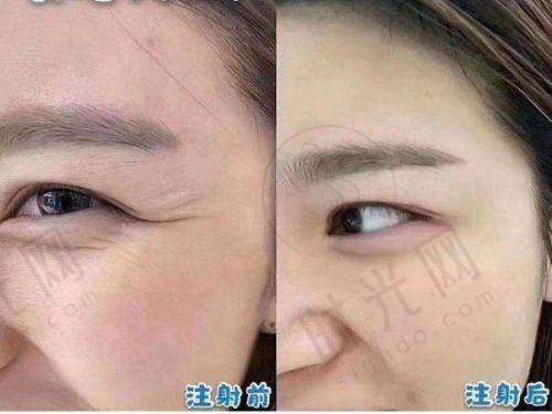 选择武汉同济鼻综合的关键要点