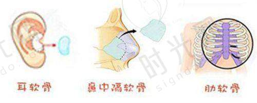 美波婷胶原丰胸安心吗
