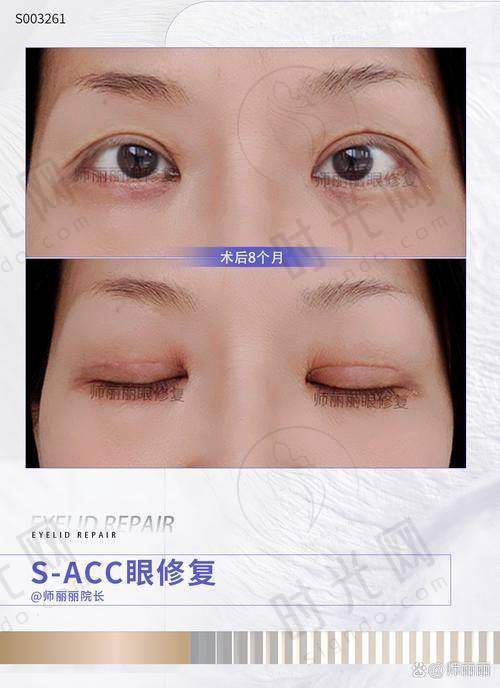 选择整形医院的关键要点