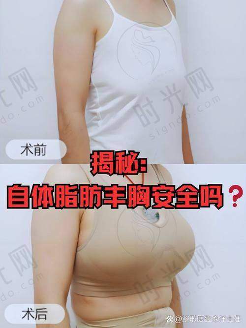 沈阳隆胸医院排名 真实实例 / 靠谱机构