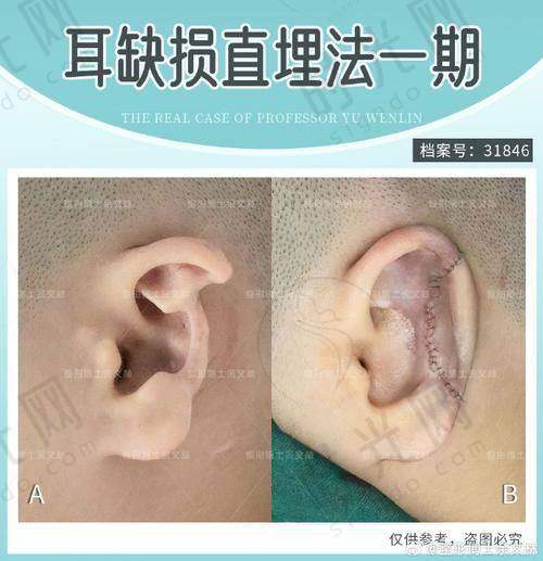 总结