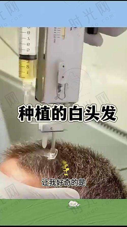 重庆万州植发机构地址