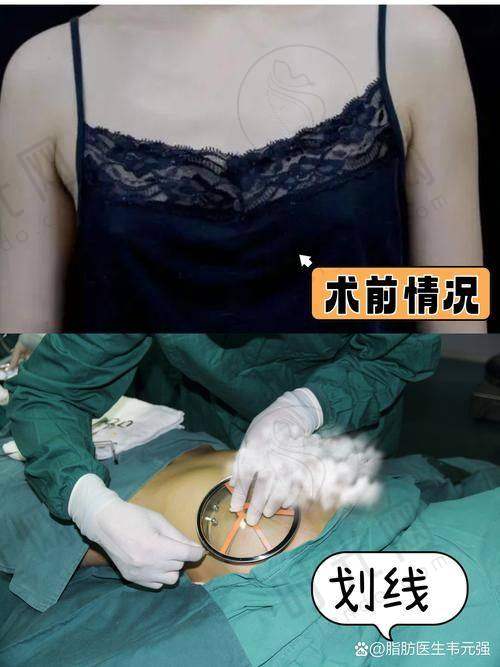 深圳艺星医疗美容医院