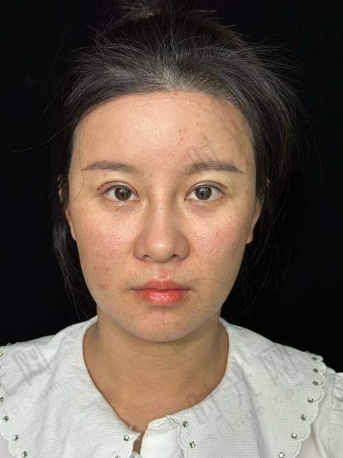 任冲医生擅长的项目有哪些
