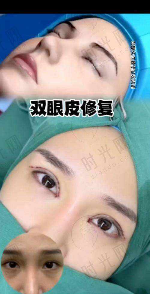 任冲医生手术的价格情况如何