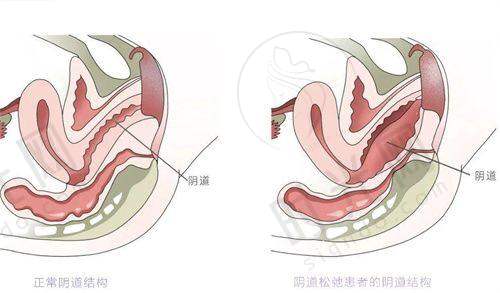 合肥正规去疤痕的医院排名榜前十地址