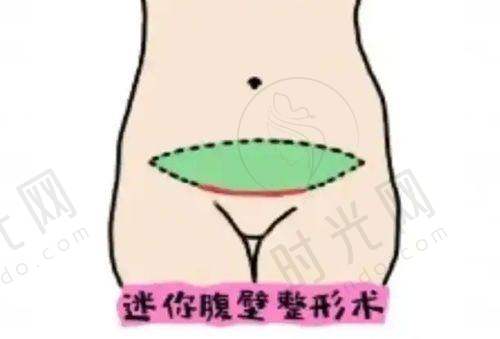 切痣多少钱一颗菏泽市立医院