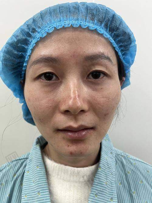 总结
