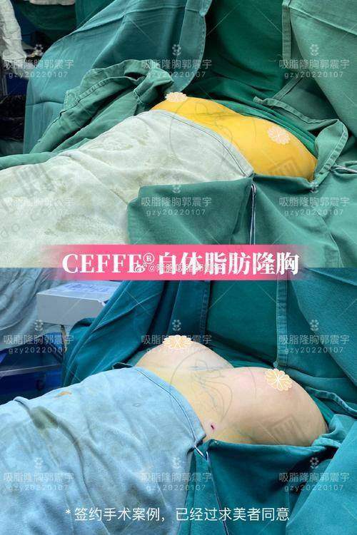 黑龙江省医院整形美容外科中 心术前术后避坑指南