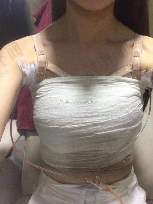 南京美莱夏建军口碑怎么样