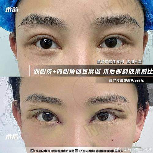 北京美憬整形外科预约挂号