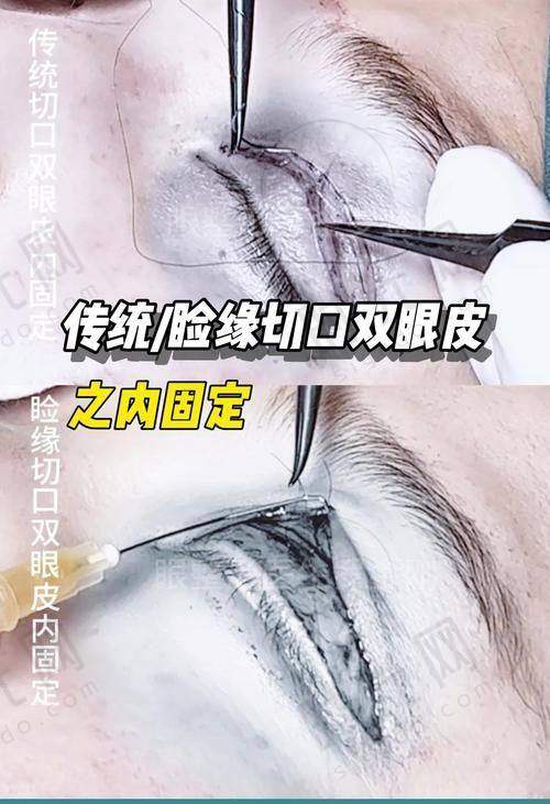 国内医生团队