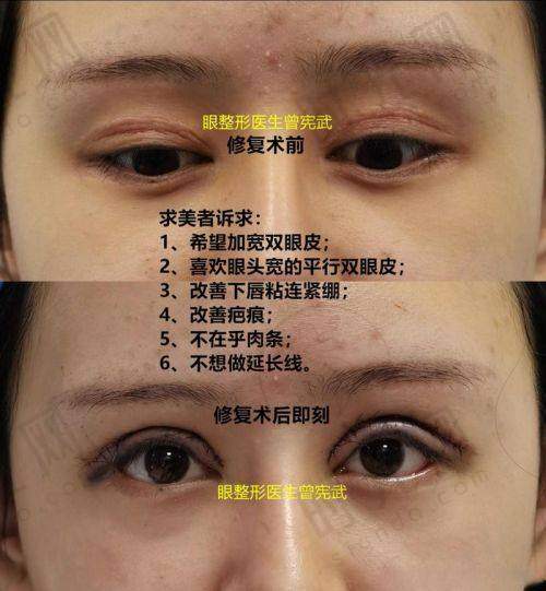 北京美憬整形外科地址电话