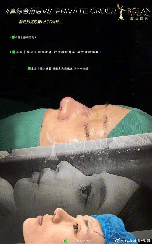 北京美憬整形外科诊疗项目