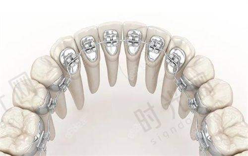 想了解深圳麦芽口腔罗湖店怎么样,价格和机构怎么选