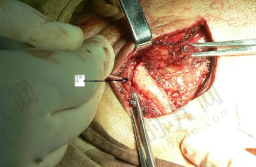 江门十大口腔医院排名 靠谱机构推荐