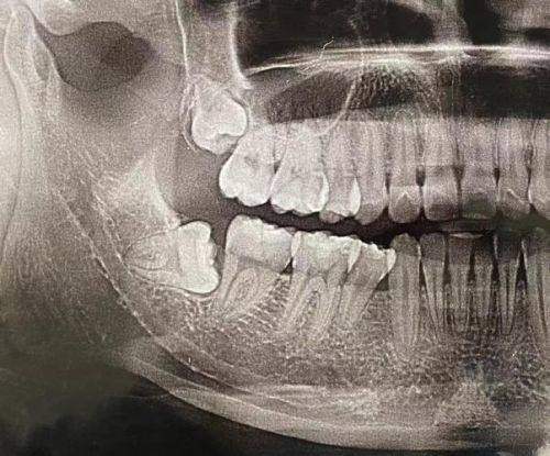 麦芽口腔医院价格表