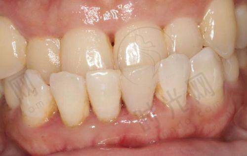 江门十大口腔医院排名术前术后避坑指南