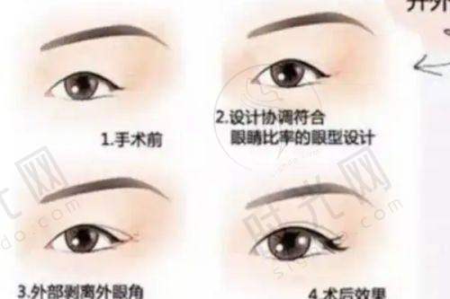 2、黄寅守医生擅长项目