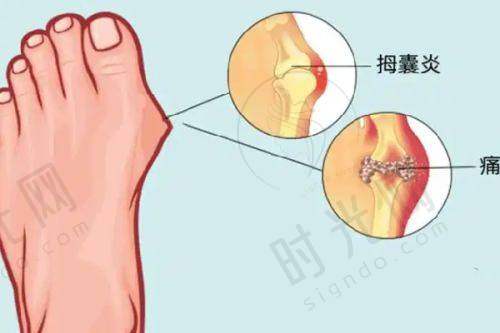 侯典举医生擅长项目