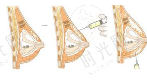 杨紫曦医生坐诊哪个医院？