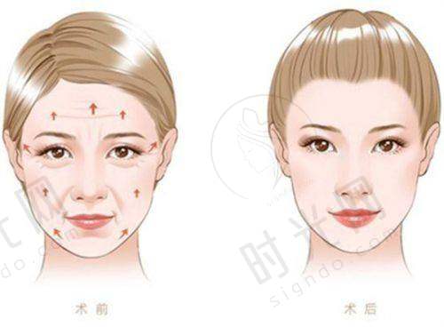 李晓东医生技术水平高