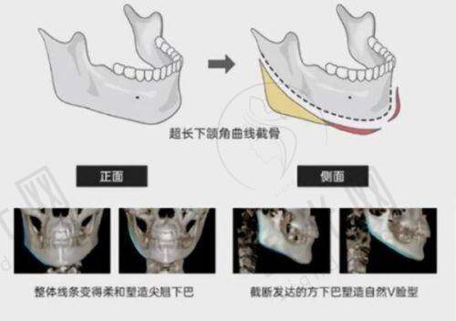 杨紫曦医生预约挂号