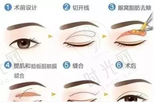 杨紫曦医生擅长项目