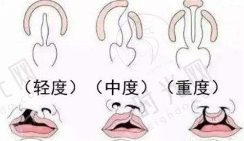 王克明医生擅长项目
