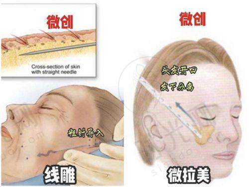 李振医生技术水平高