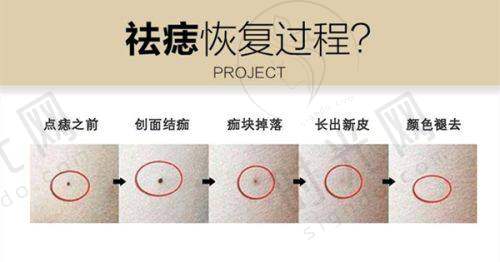 夏正义医生价格表（2025年全新）