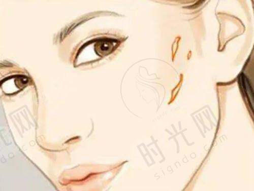 3、杜太超医生技术水平高