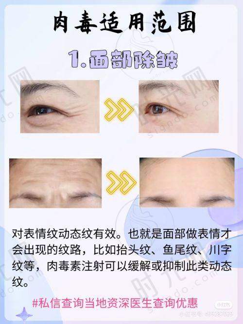 李文海医生预约挂号