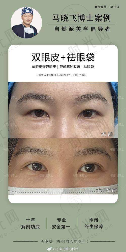 二、李炳浍医生擅长项目