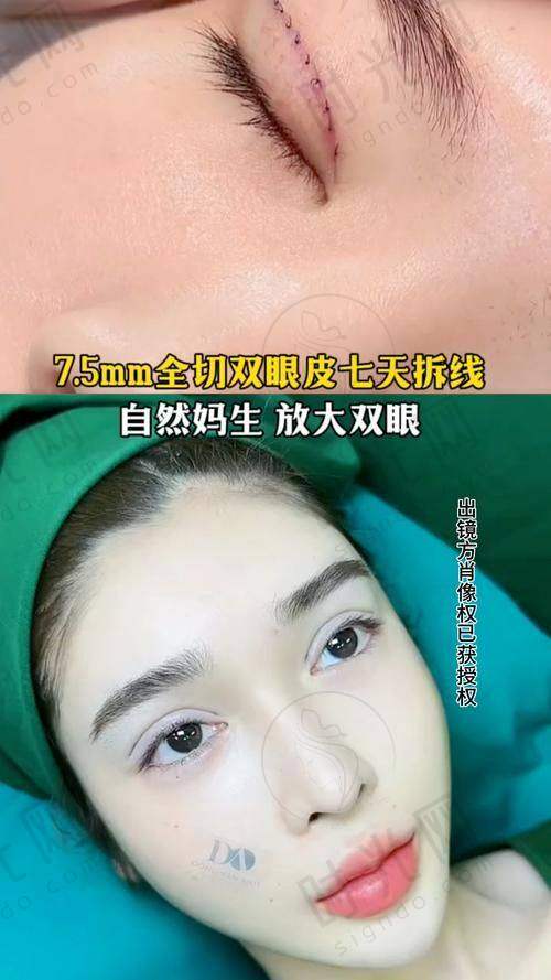曾昂医生擅长项目