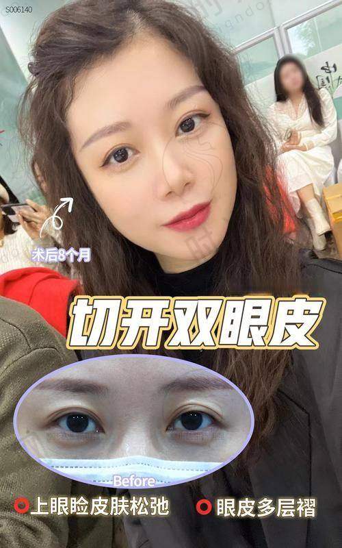 杨喆医生预约挂号