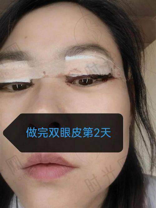 杨喆医生价格表（2025年全新）