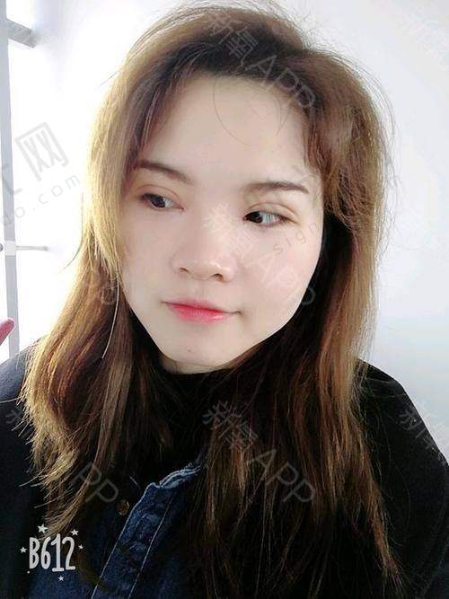 杨喆医生技术水平高