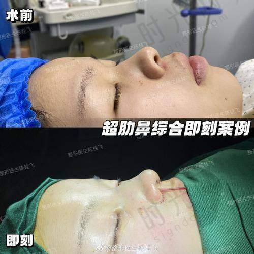 刘立强医生擅长项目