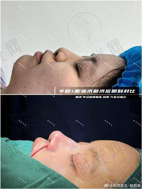 钟彤医生预约挂号