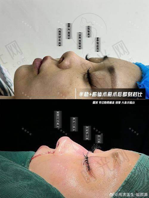 杨明勇医生口碑评价及反馈内容