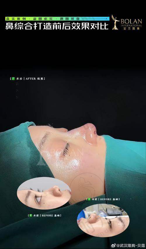 钟彤医生擅长项目
