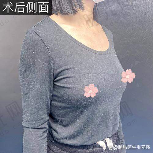 刘立强医生价格表（2025年全新）