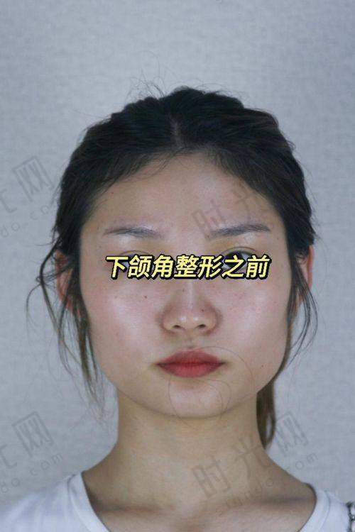 邱立东医生擅长项目