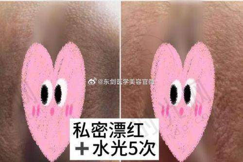 3、毛运春医生技术水平高