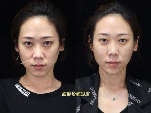 刘立强医生坐诊哪个医院？
