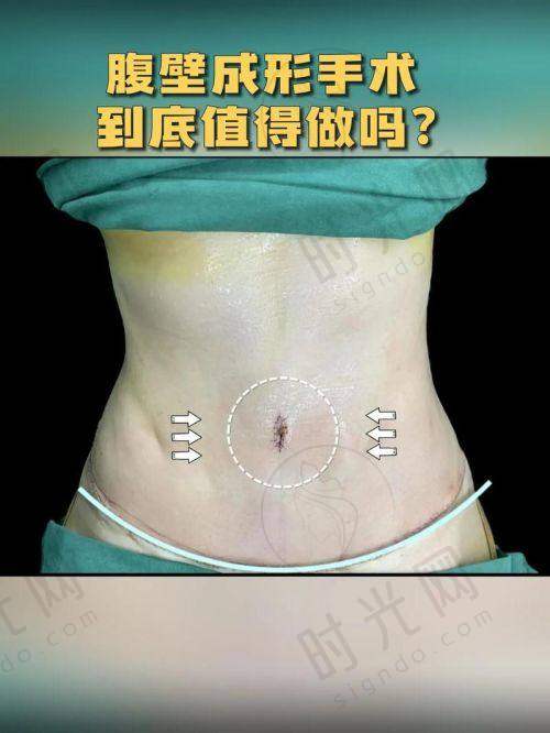 侯典举医生个人资料简介