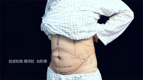 韩万旭医生技术水平高